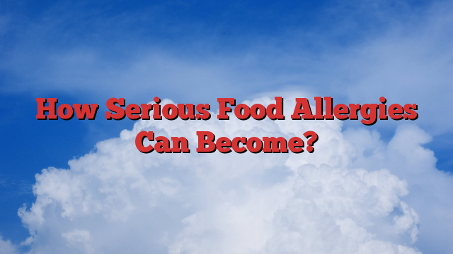 How Serious Food Allergies Can Become?