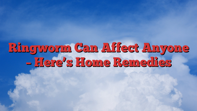 Ringworm Can Affect Anyone – Here’s Home Remedies