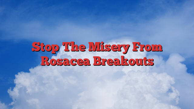 Stop The Misery From Rosacea Breakouts